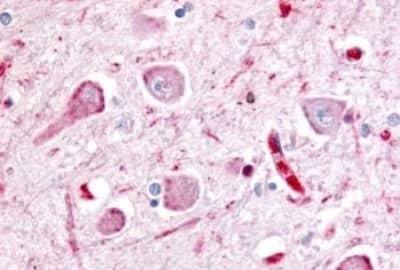 Immunohistochemistry: Wnt-8a Antibody [NBP3-14523]